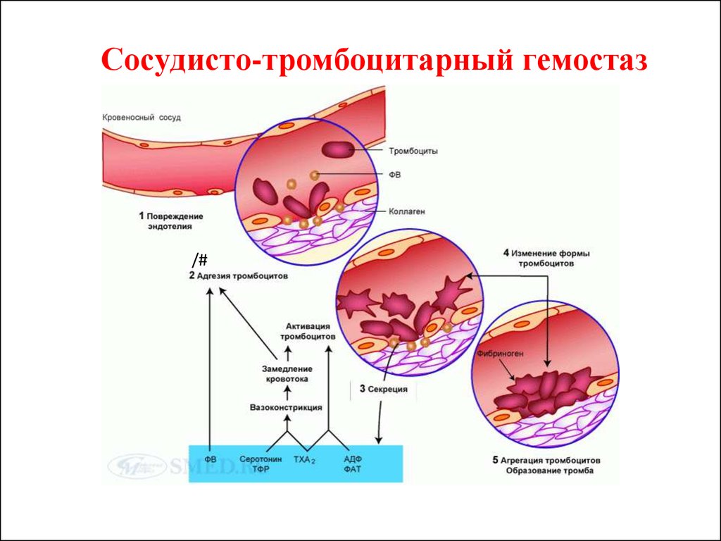 Образование тромба попадание факторов свертывания в плазме. Тромбоцитарный механизм гемостаза. Сосудисто тромбоцитарный механизм свертывания крови. Сосудисто тромбоцитарный механизм свертывания. Тромбоциты механизм свертывания крови.