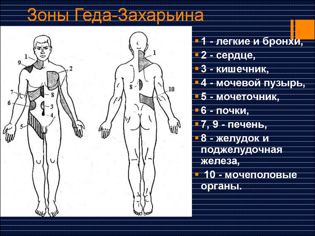 Схема захарьина геда