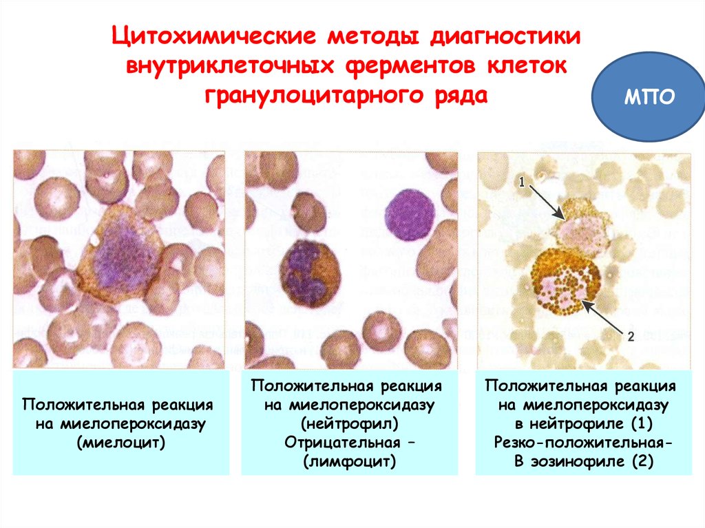 Реакция клеток. Цитохимическая реакция на миелопероксидазу. Цитохимические методы исследования клетки. Положительная реакция на миелопероксидазу. Цитохимические методы исследования клетки костного мозга.