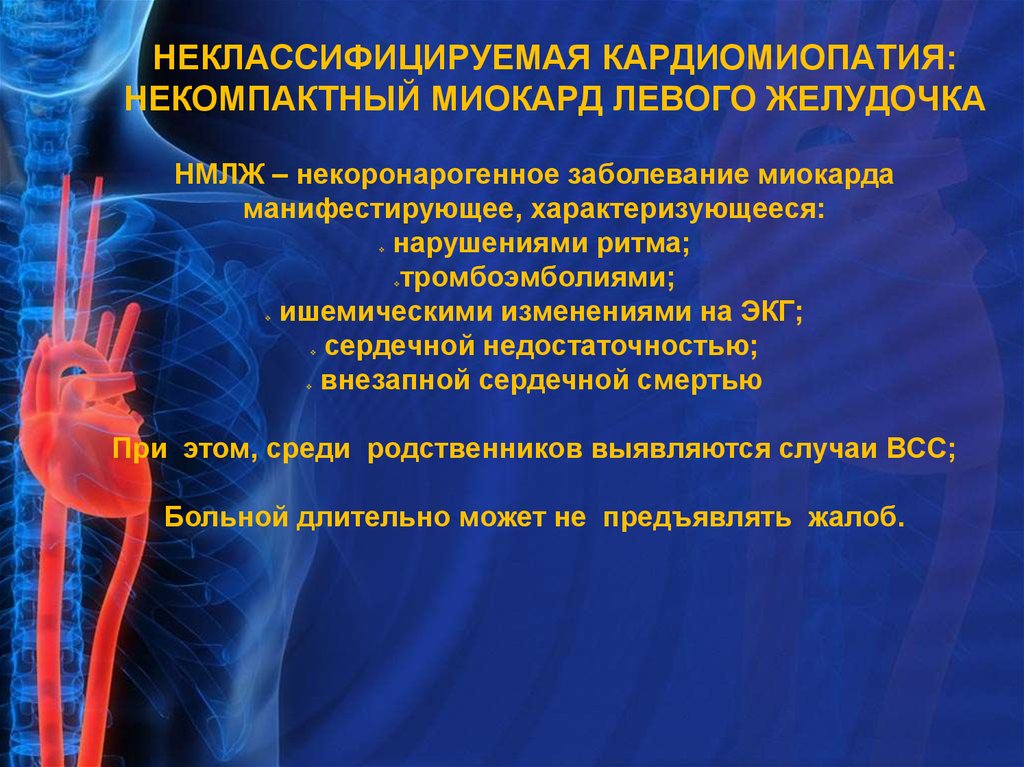 Заболевания миокарда. Некомпактный миокард. Неклассифицируемая кардиомиопатия. Кардиомиопатия некомпактного миокарда это. Некомпактный миокард левого желудочка.