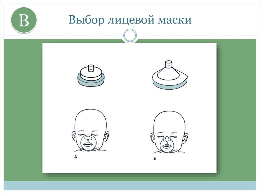 Размеры лицевой маски. Схема картинка новорожденный лицевая маска.