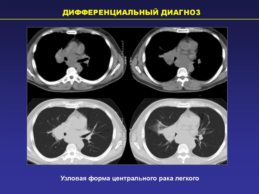 Кт легких презентация