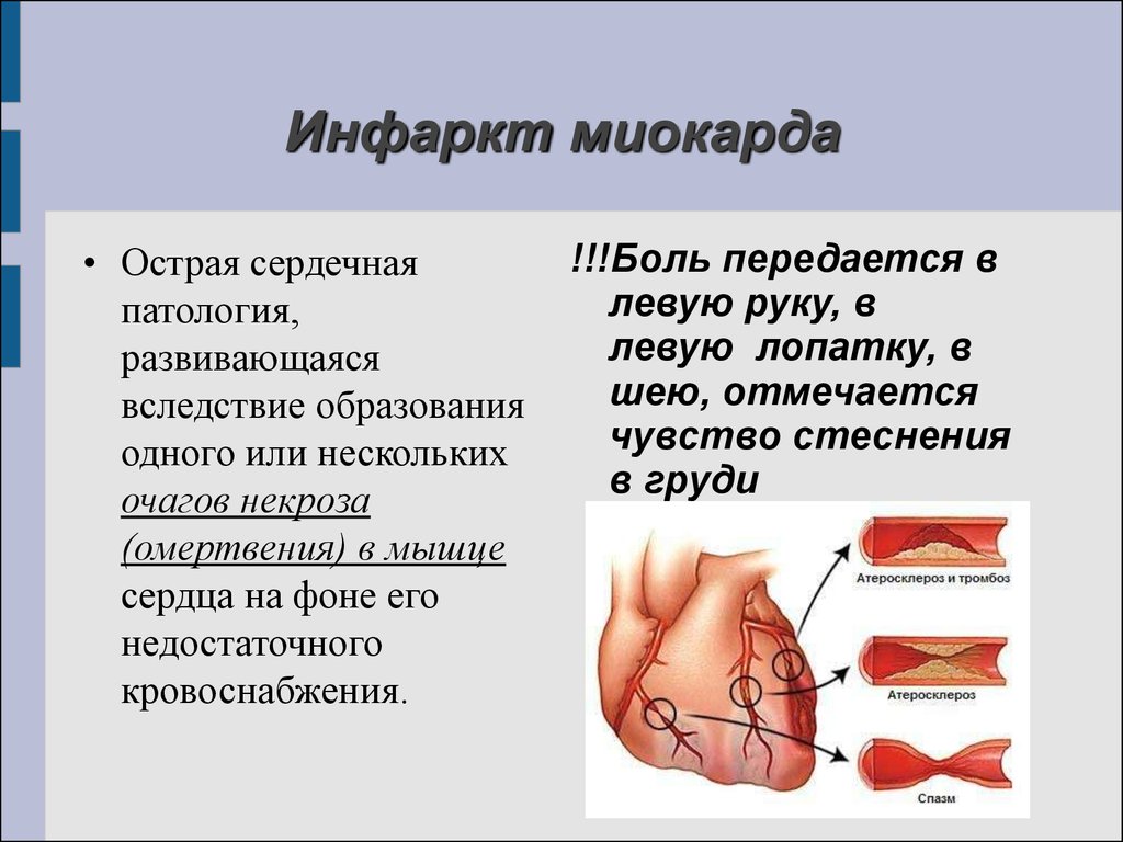 Заболевания сердца презентация