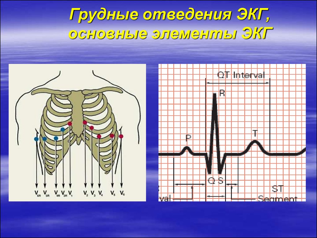 Дополнительные отведения экг презентация