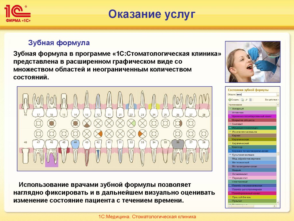 Цветовая карта зуба