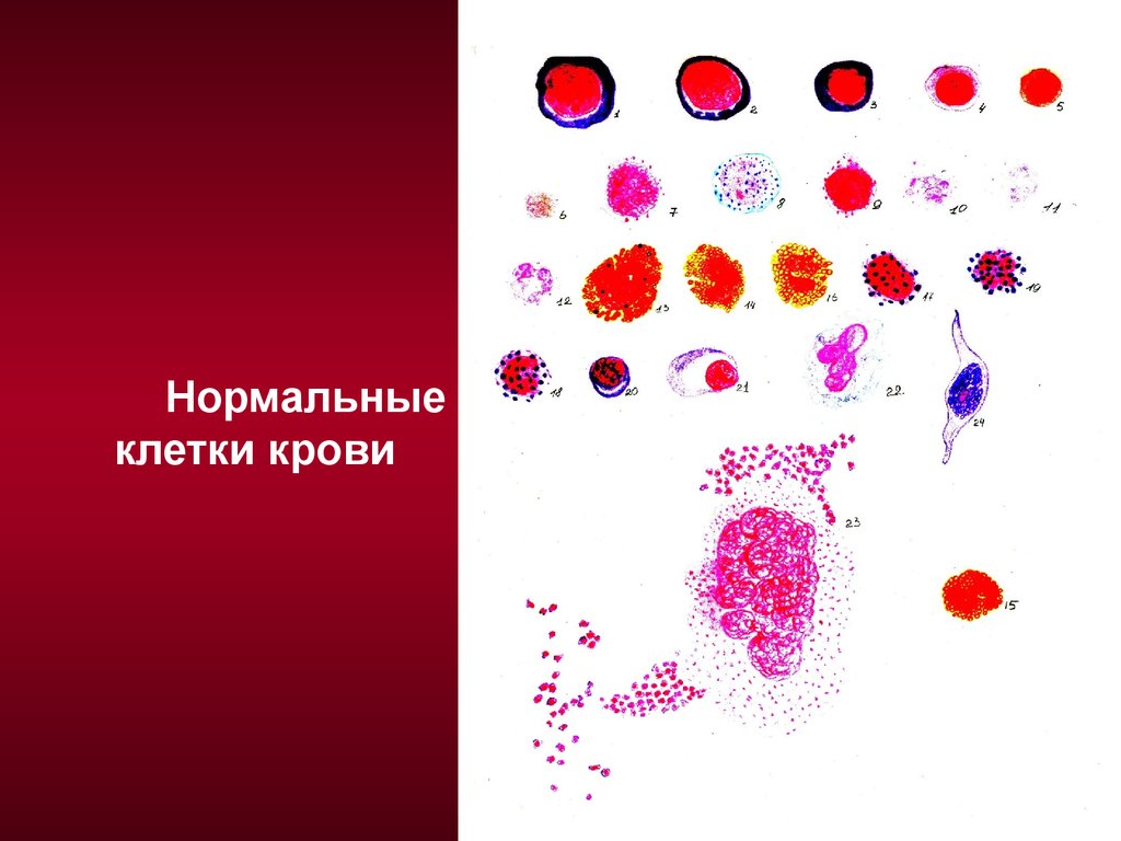 Схема клеток крови. Нормальные клетки крови. Нормальная клетка. Гемопоэз крови. Кров.кроветворения рисунок.
