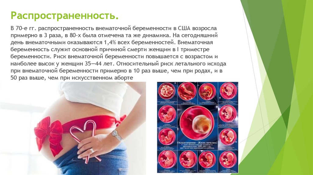 Ли сохранить внематочную беременность. Внематочная беременность. Профилактика трубной беременности. Профилактика внематочная. Факторы риска внематочной беременности.