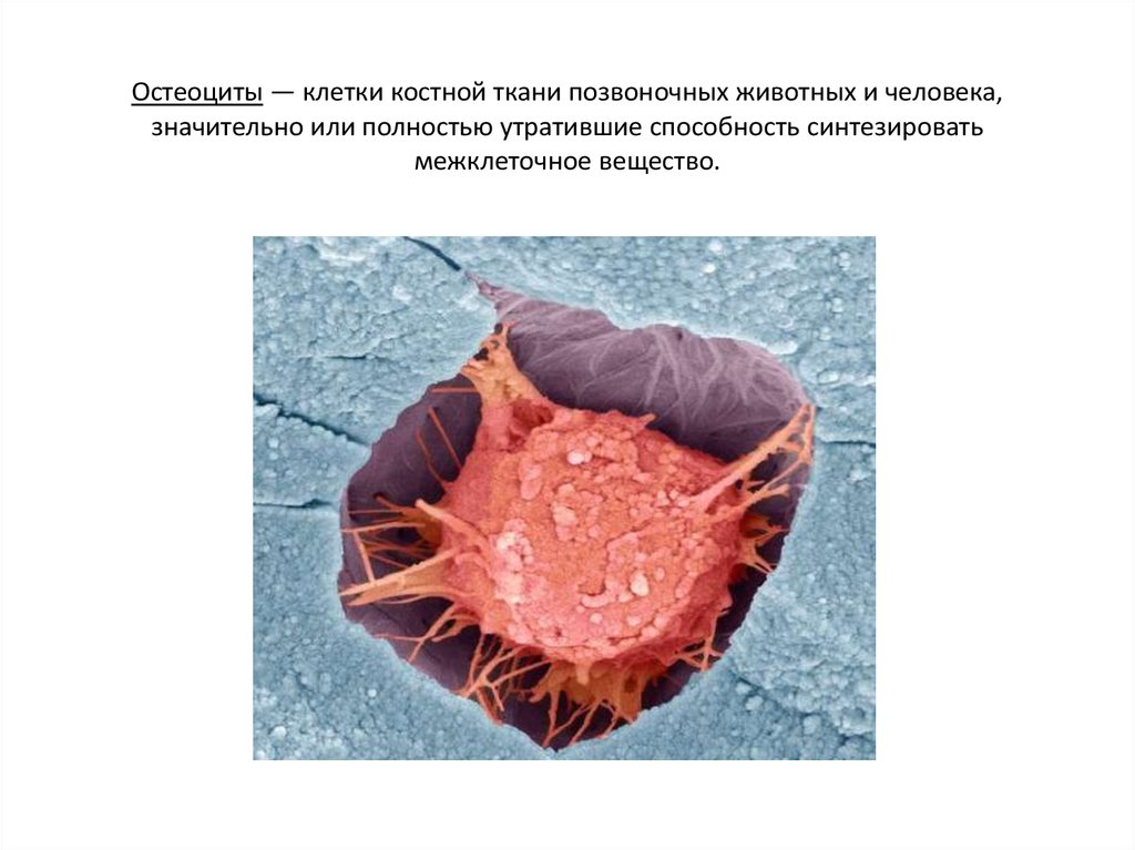 Остеоцит. Костные клетки остеоциты. Костная ткань остеоциты. Остеоциты это в анатомии. Остеоциты локализация.