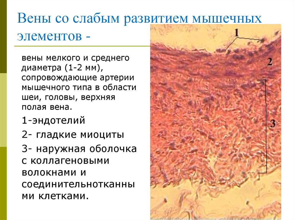 Типа вена. Вена мышечного типа гистология. Вены с сильным развитием мышечных элементов гистология. Вены со слабым развитием мышечных элементов гистология. Вены безмышечного типа препарат.