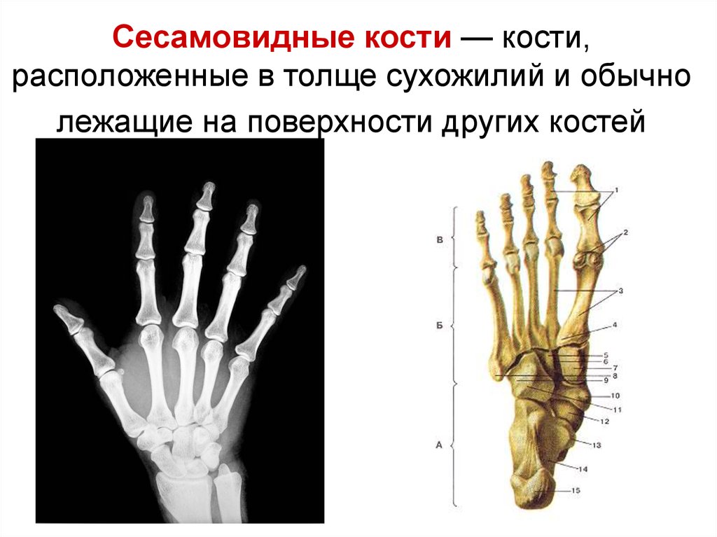 Сесамовидные кости. Сесамовидные кости запястья. Кости запястья анатомия сесамовидная кость. Кости стопы сесамовидные кости. Гороховидная кость сесамовидная.