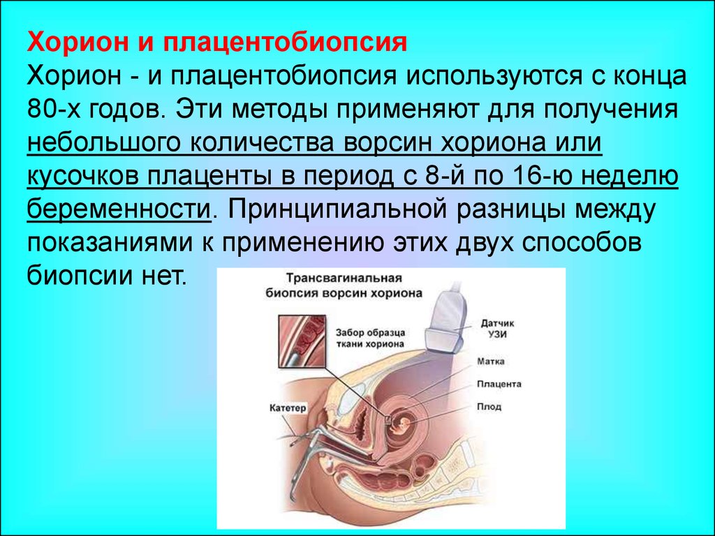 Биопсия ворсин хориона. Хорион. Хорионбиопсия плацентобиопсия. Хорион и плацентобиопсия. Трансвагинальная биопсия ворсин хориона.