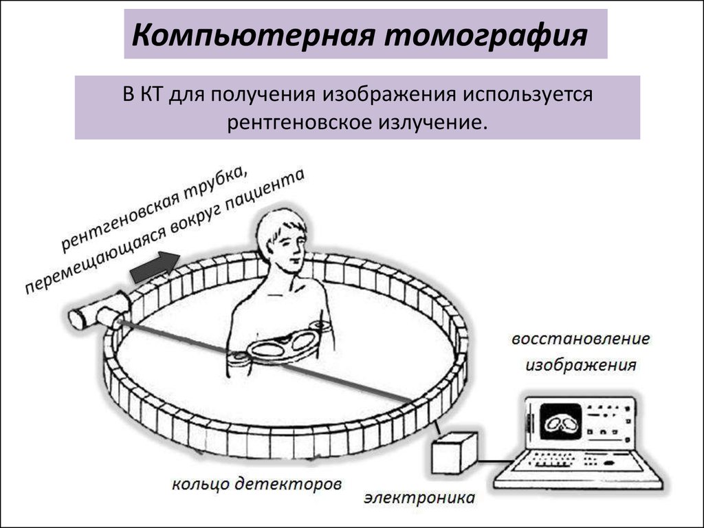 Для получения изображения в компьютерной томографии используется