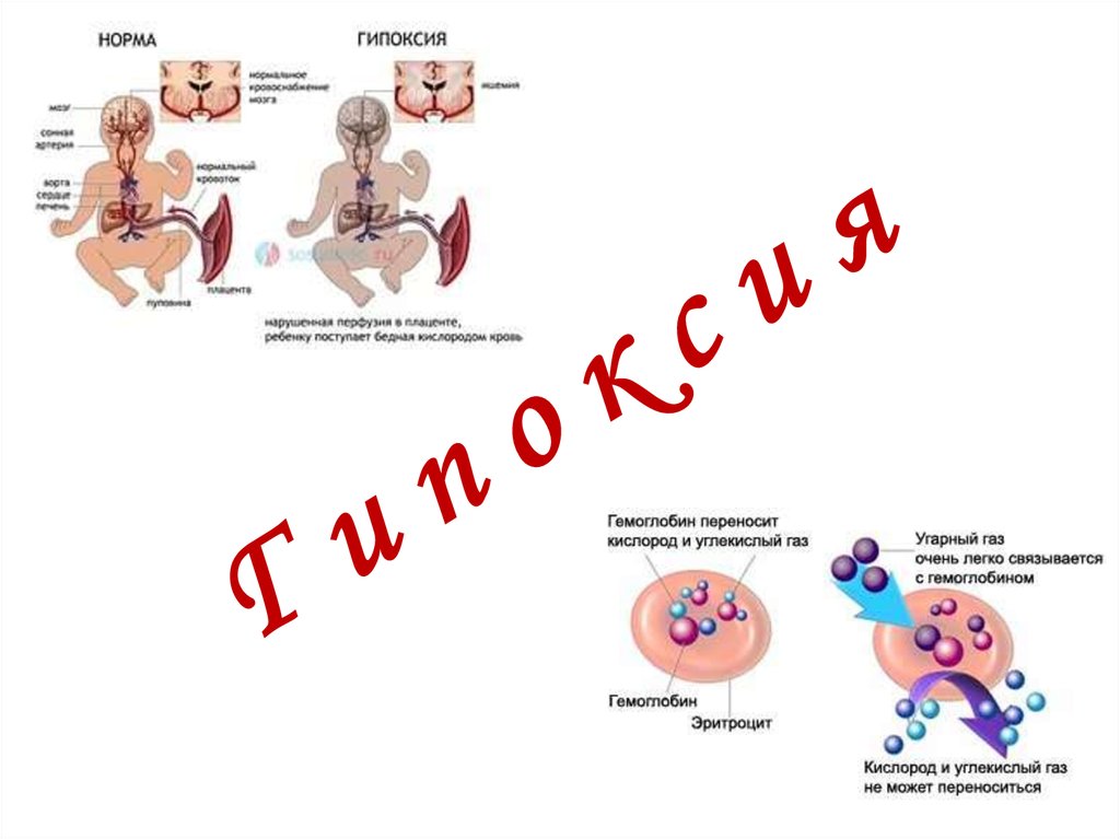 Гипоксия презентация картинки