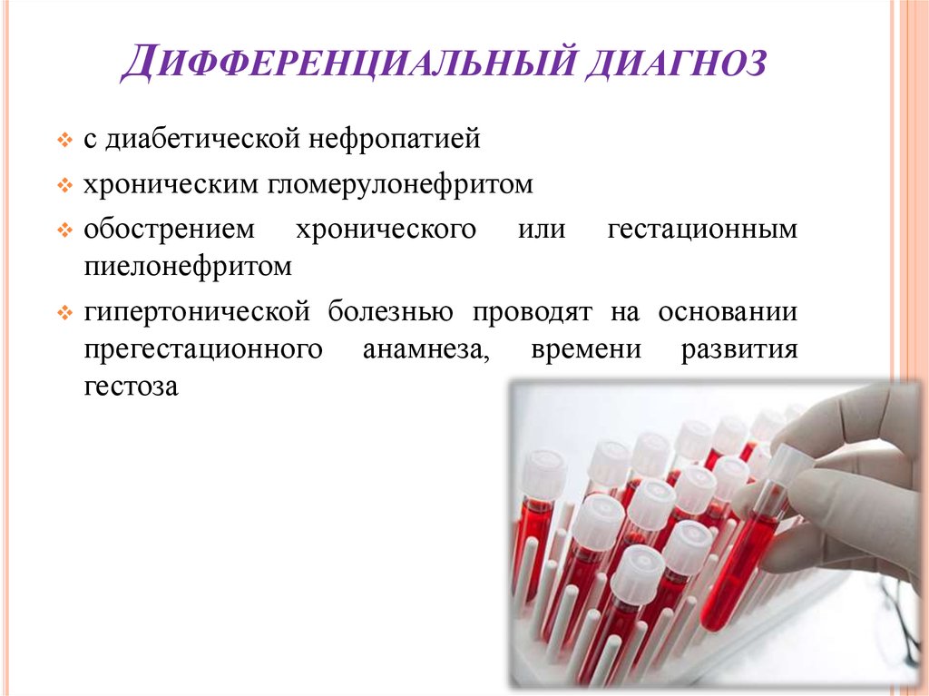 Гипертоническая нефропатия презентация