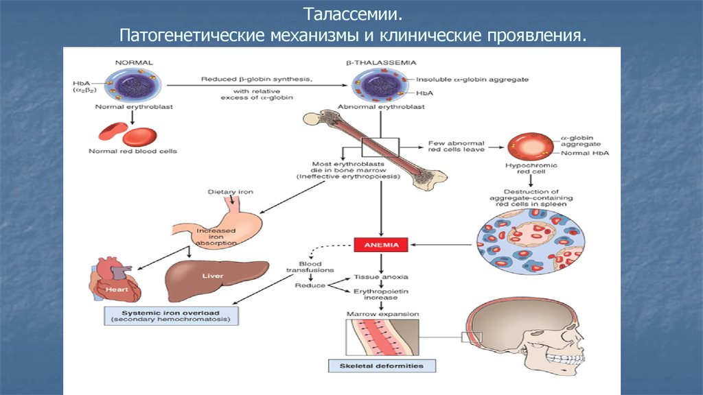 Талассемия что это. Альфа талассемия биохимия. Клинические проявления талассемии. Талассемия анемия патогенез. Талассемия клинические симптомы.