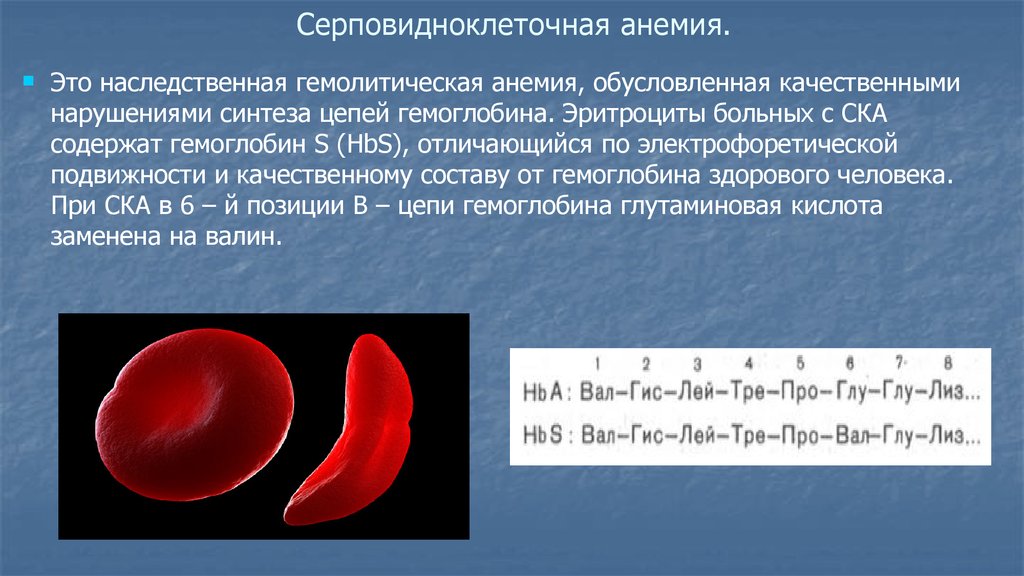 Ген серповидноклеточной анемии. Серповидноклеточная анемия кариотип больного. Серповидная клеточная анемия гемоглобин. Серповидноклеточная анемия эритроциты. Строение гемоглобина при серповидноклеточной анемии.