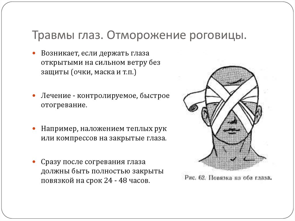 При ранениях глаз или век. Повязка при холодовой травме. Повязка на глаз при травме. Повязка при ранении глаза.