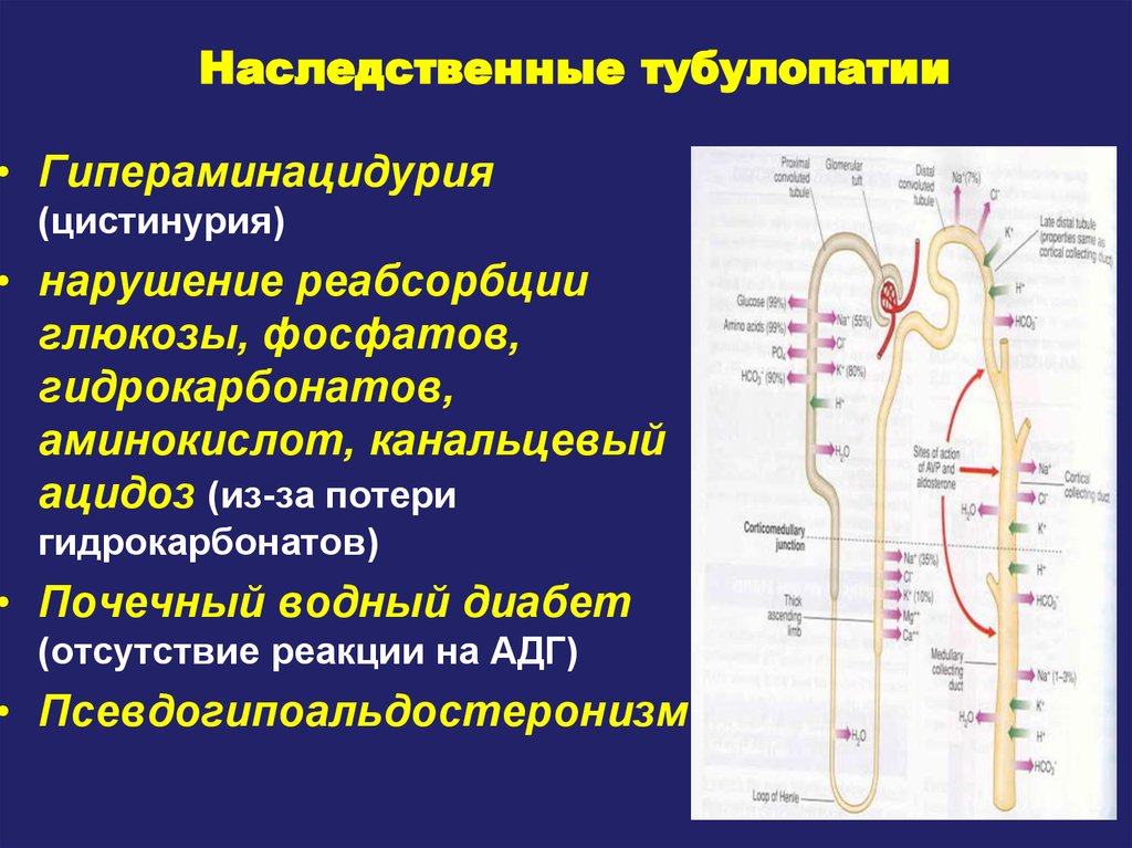 Почечный диабет. Нарушение функции канальцев-тубулопатии. Наследственные тубулопатии. Наслклственне туьклопатии. Наследственные тубулопатии у детей.