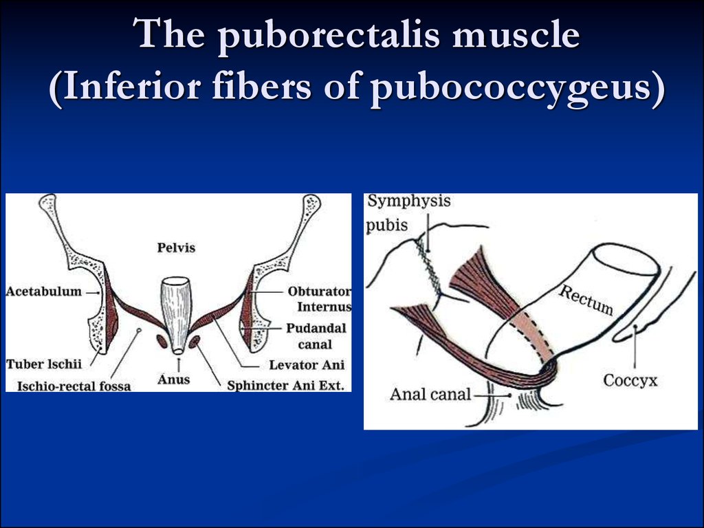 Pelvic аnatomy - презентация онлайн