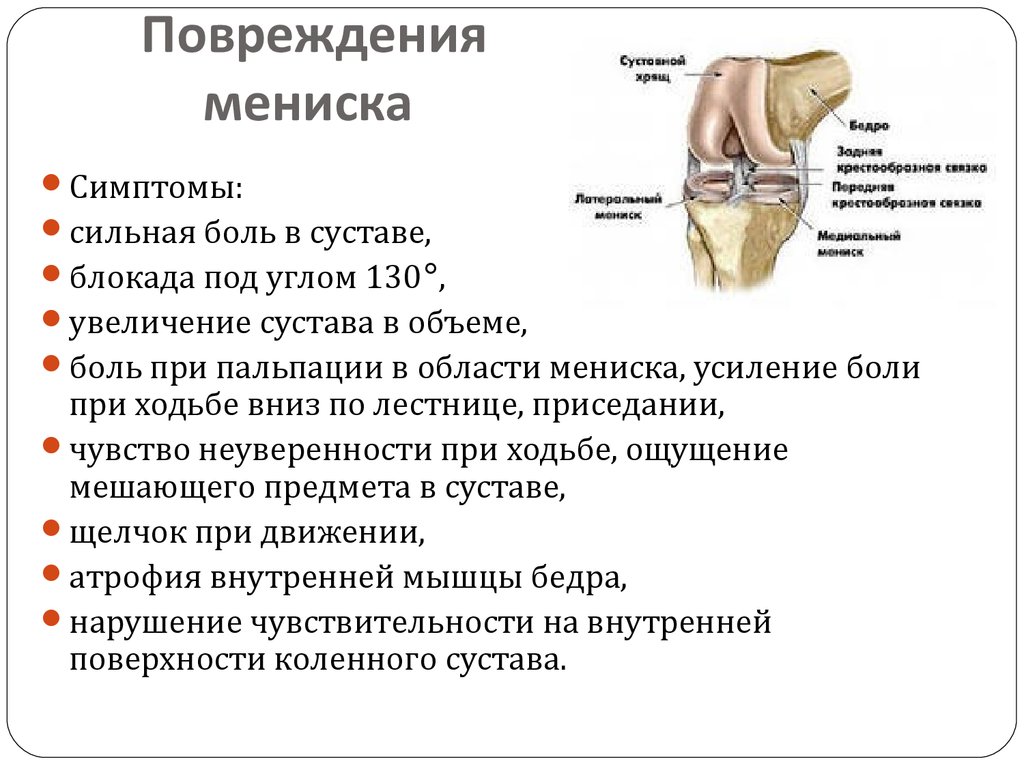 Статус локалис суставов. Симптомы повреждения мениска. Симптомы поврежденного мениска. Симптомы повреждения коленного мениска. Травма мениска коленного сустава симптомы.