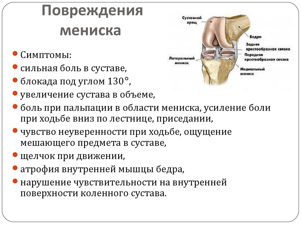 Колено болит с внутренней. Повреждение мениска коленного сустава симптомы. Симптомы повреждения мениска. Симптомы поврежденного мениска. Болит колено сбоку с внутренней стороны.