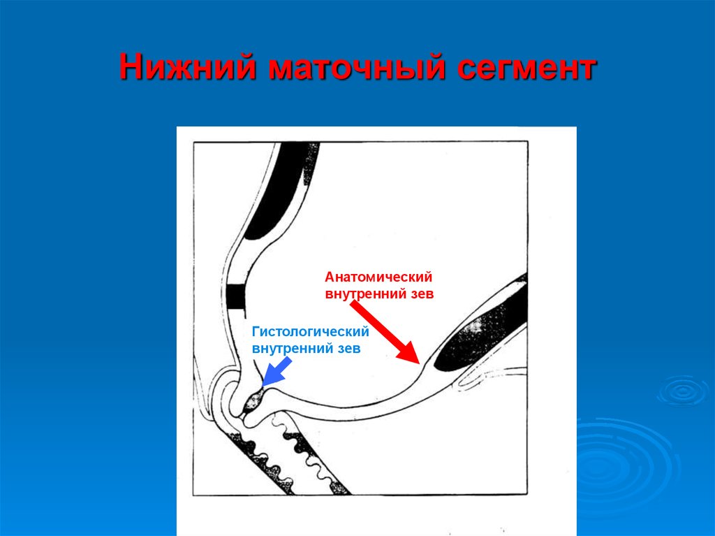 Внутренний зев. Нижний маточный сегмент. Нижний маточный сегмент формируется. Гистологический внутренний зев.