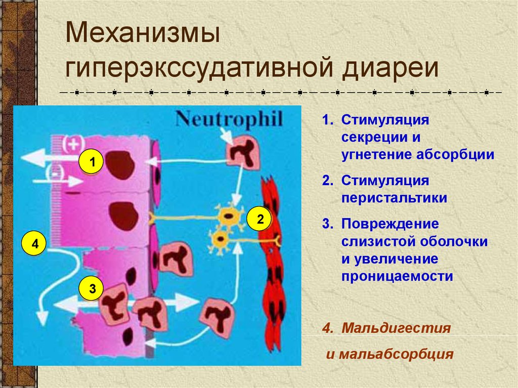 Механизмы диареи. Синдром мальабсорбции и мальдигестии патофизиология. Гиперэкссудативная диарея механизм. Синдром мальдигестии патогенез. Мальдигестия патофизиология.