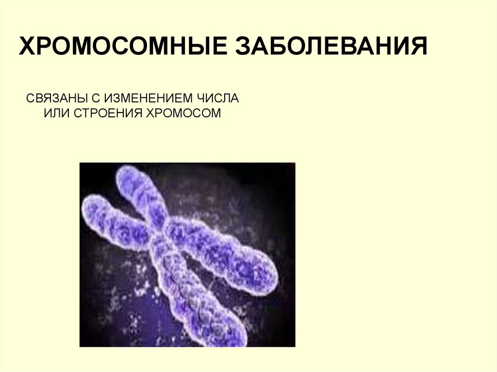 С изменением структуры хромосом связаны. Хромосомные нарушения. Наследственные заболевания человека. Хромосомные заболевания человека.