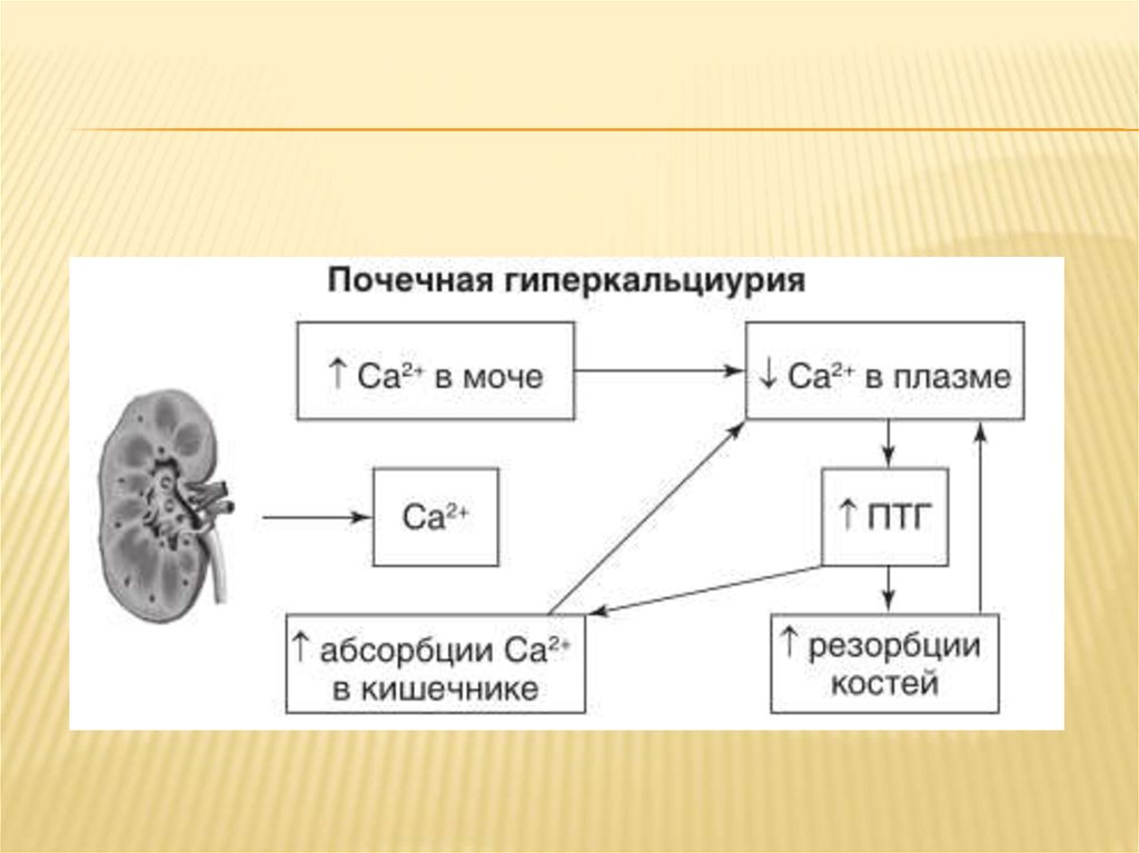 Гиперкальциурия. Мочекаменная болезнь этиология и патогенез. Гиперкальциурия абсорбтивного типа. Гиперкальциурия причины.