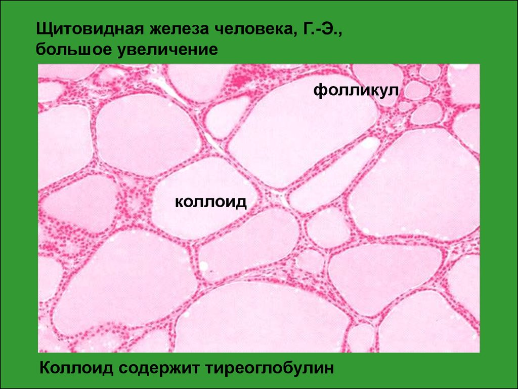 Коллоид щитовидной железы