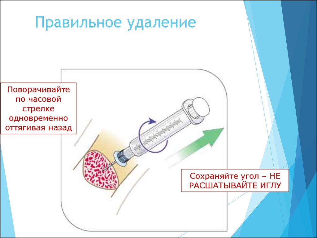 Как правильно удаленные. Методах как правильно удаление. Средства правильное удаление. Какая будет правильно удаление.