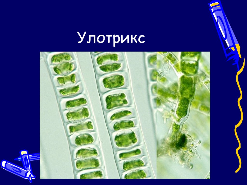 Улотрикс относится к водорослям. Ламинария и улотрикс. Зеленые водоросли улотрикс. Улотрикс клеточная стенка. Нитчатый таллом улотрикса.