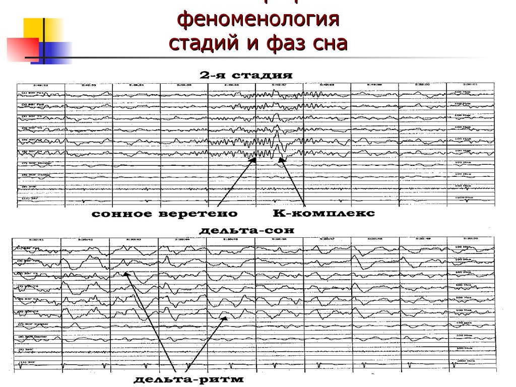 Фазы сна. Features of Phenomenology.