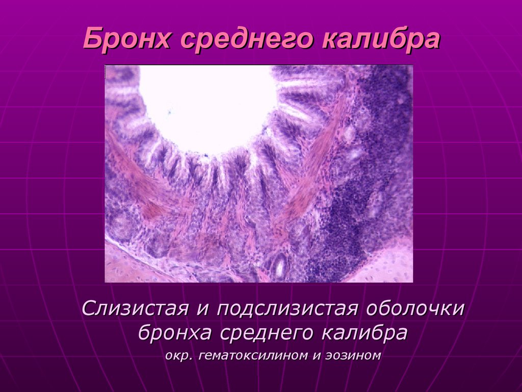 Оболочки бронхов. Эпителий бронхов среднего калибра. Бронх среднего калибра. Бронх среднего калибра гистология. Оболочки бронха среднего калибра.