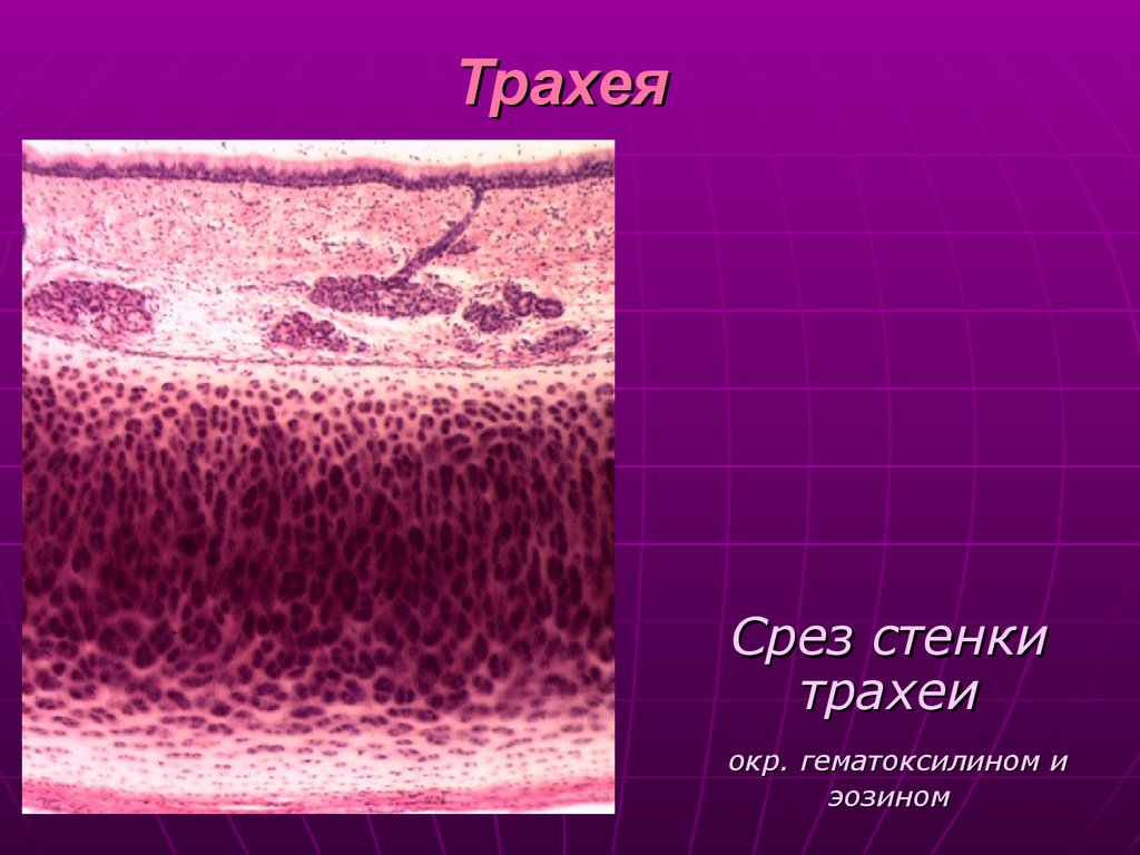 Трахея гистология препарат рисунок