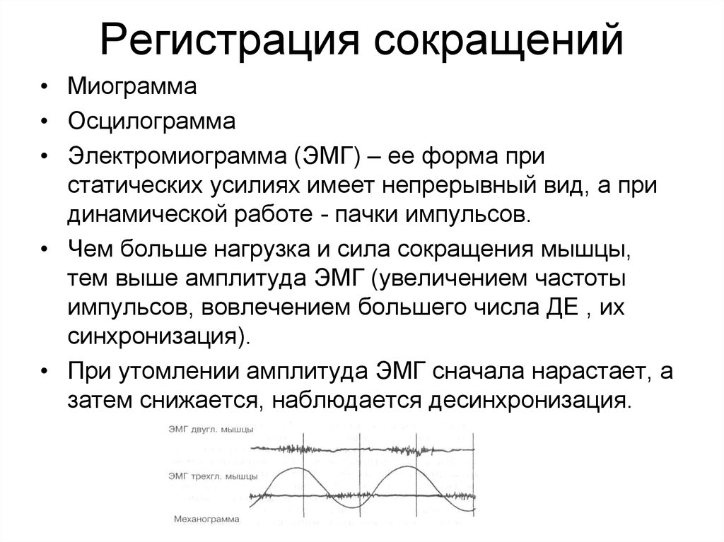 Частота сокращения сила сокращения. Миограмма. Миограмма сокращения мышцы. Миограмма физиология. Миограмма одиночного сокращения мышцы.