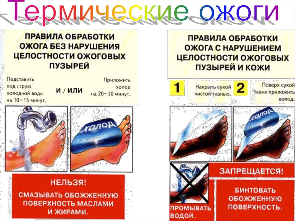 Перечисленные ожогов. Правила обработки ожога с нарушением. Правила обработки ожогас напушением уелостности. Правила обработки ожога с нарушением целостности ожоговых. Термический ожог без нарушения целостности ожоговых пузырей.