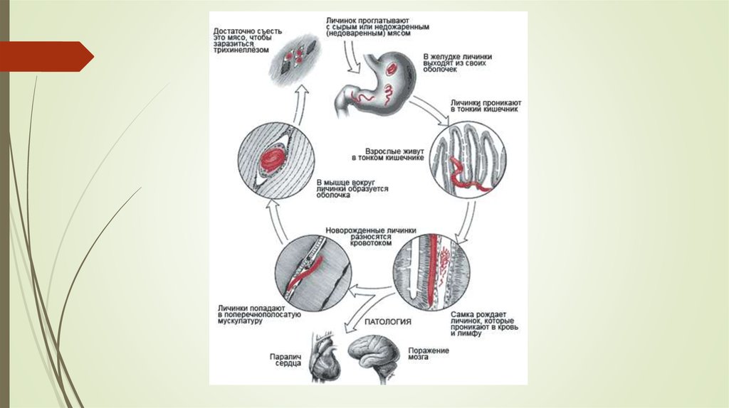Жизненный цикл трихинеллеза схема