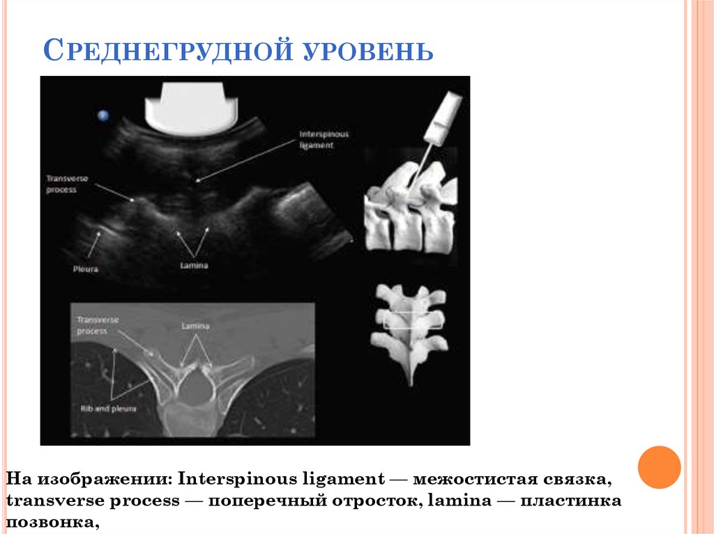 Пластинка позвонка