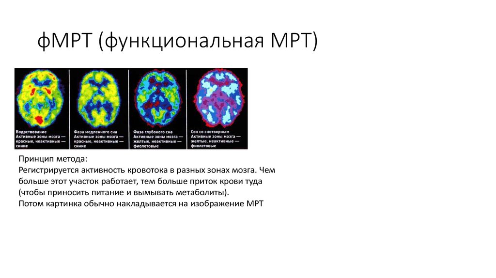 Метод нс. Магнитно-резонансная томография головного мозга физиология. ФМРТ И мрт различия. Функциональная магнитно-резонансная томография. Мрт и ФМРТ разница.