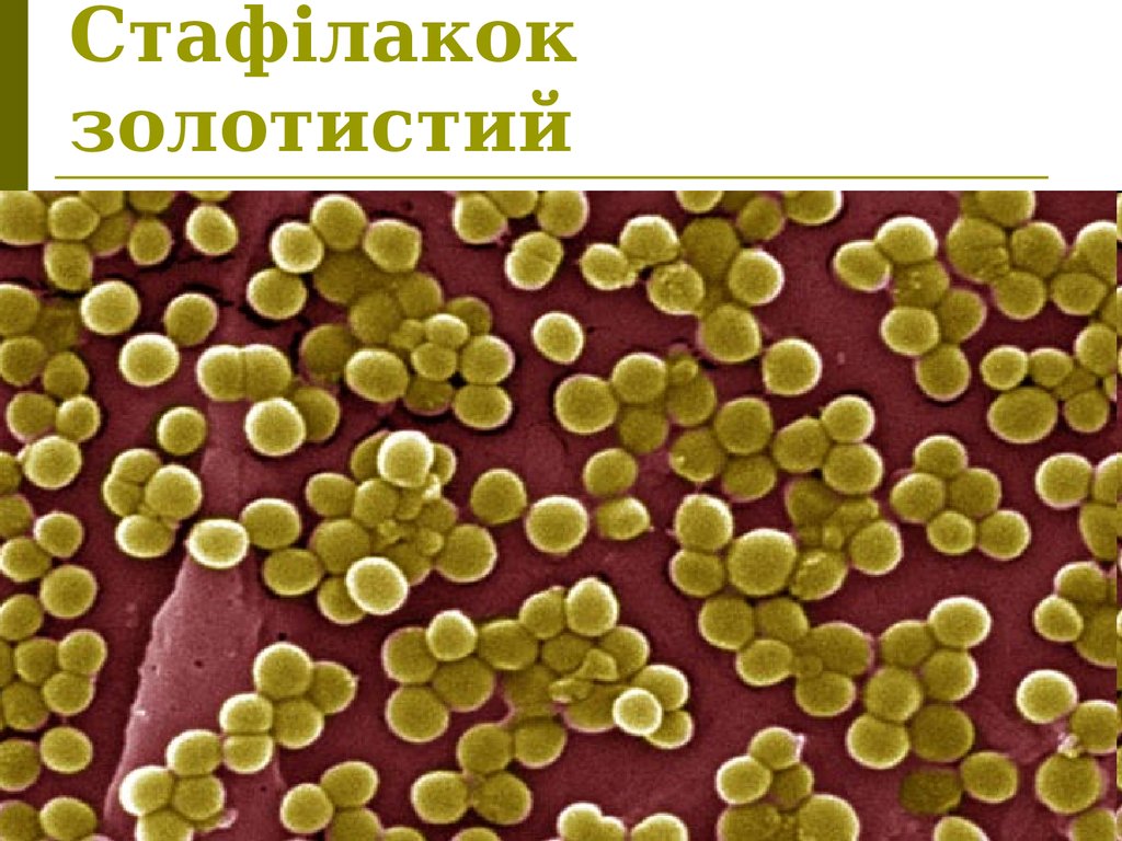 Staphylococcus aureus 3. Бактерия золотистый стафилококк. Золотистый стафилококк септицемия. St. aureus (золотистый стафилококк. Стафилококк золотистый Staphylococcus aureus.