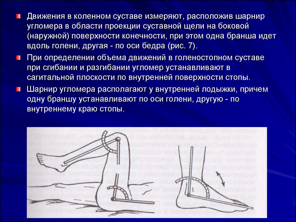 Ограничение движения в коленном суставе