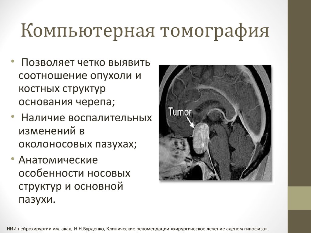 Диагностика аденомы