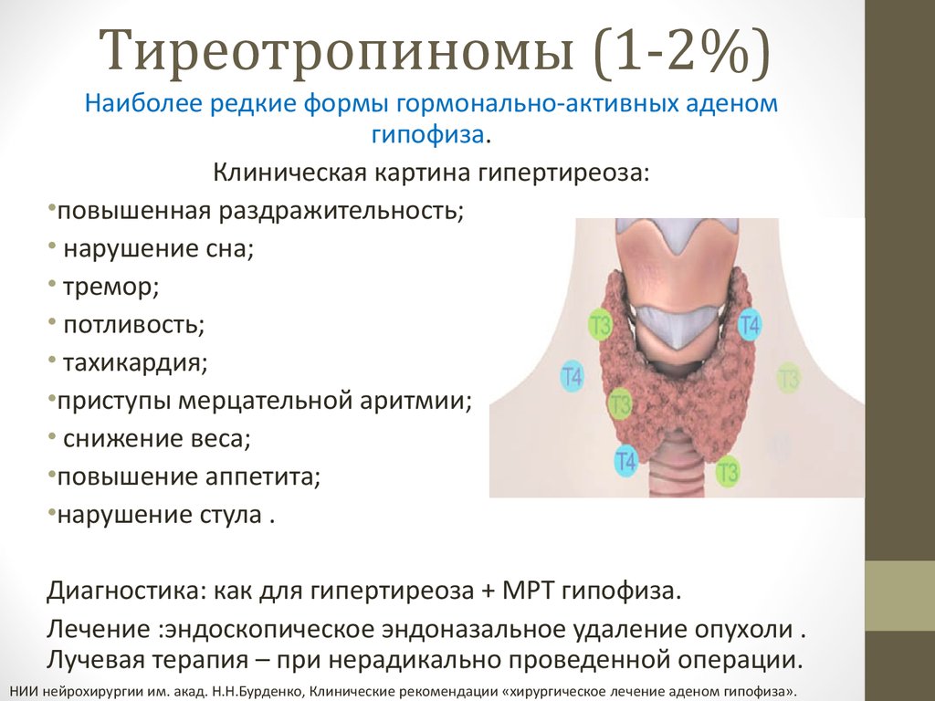 Щитовидная железа симптомы щитовидной железы. Тиреотропинома симптомы. Аденома щитовидной железы симптомы. Аденома в щитовидной железе. ТТГ-продуцирующая аденома гипофиза:.