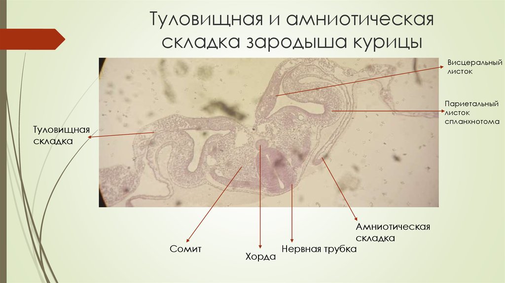 Стадии зародыша курицы. Туловищная и амниотическая складки препарат гистология. Туловищная складка гистология. Туловищная и амниотическая складки зародыша курицы. Зародыш курицы туловищная и амниотическая складки зародыша курицы.