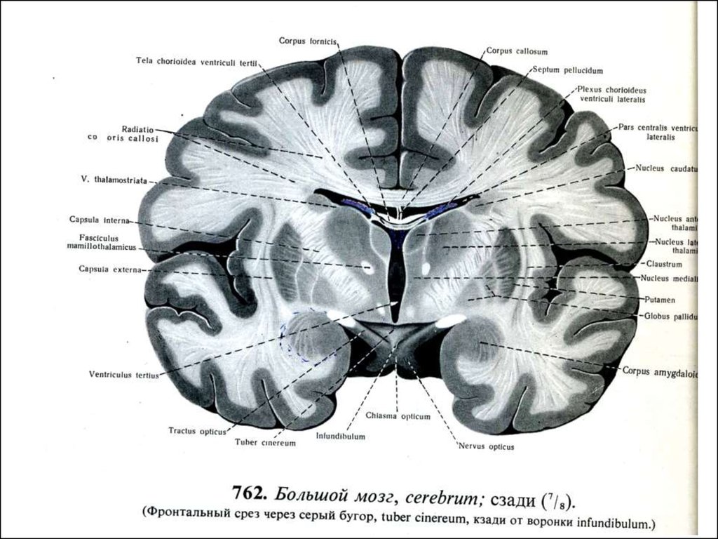 Лобные латынь. Commissura fornicis анатомия. Фронтальный разрез головного мозга. Фронтальный срез головного мозга. Базальные ганглии.