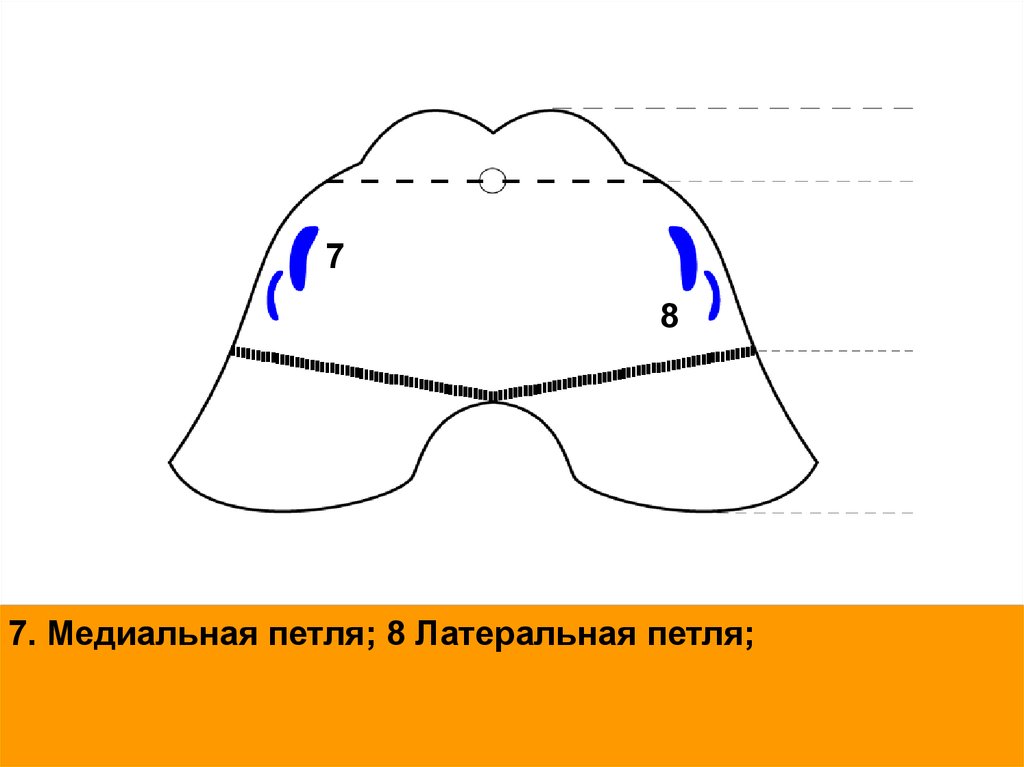 Латеральная петля. Медиальная петля положение на срезах мозга.