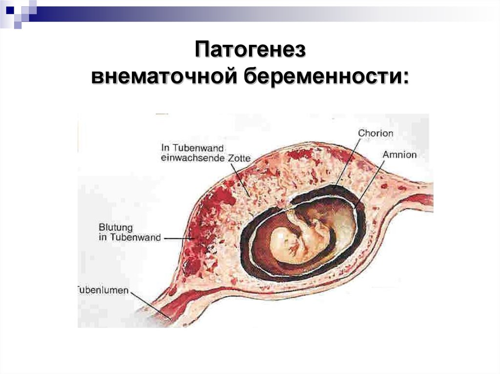 Беременность простейших