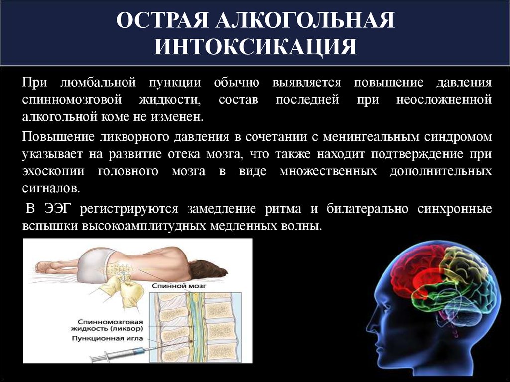 Интоксикация организма алкоголем. Симптомы алкогольной интоксикации организма. Алкогольная интоксикация симптомы. Интоксикация организма симптомы. От интоксикации организма алкоголем.