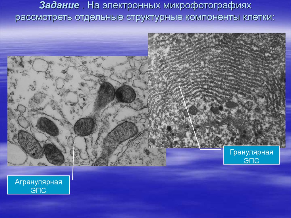 Рассмотрите световую микрофотографию. Гранулярная ЭПС Электронограмма. Плазматическая клетка электронная микрофотография. Микрофото агранулярная ЭПС. Мембрана клетки электронная микрофотография.